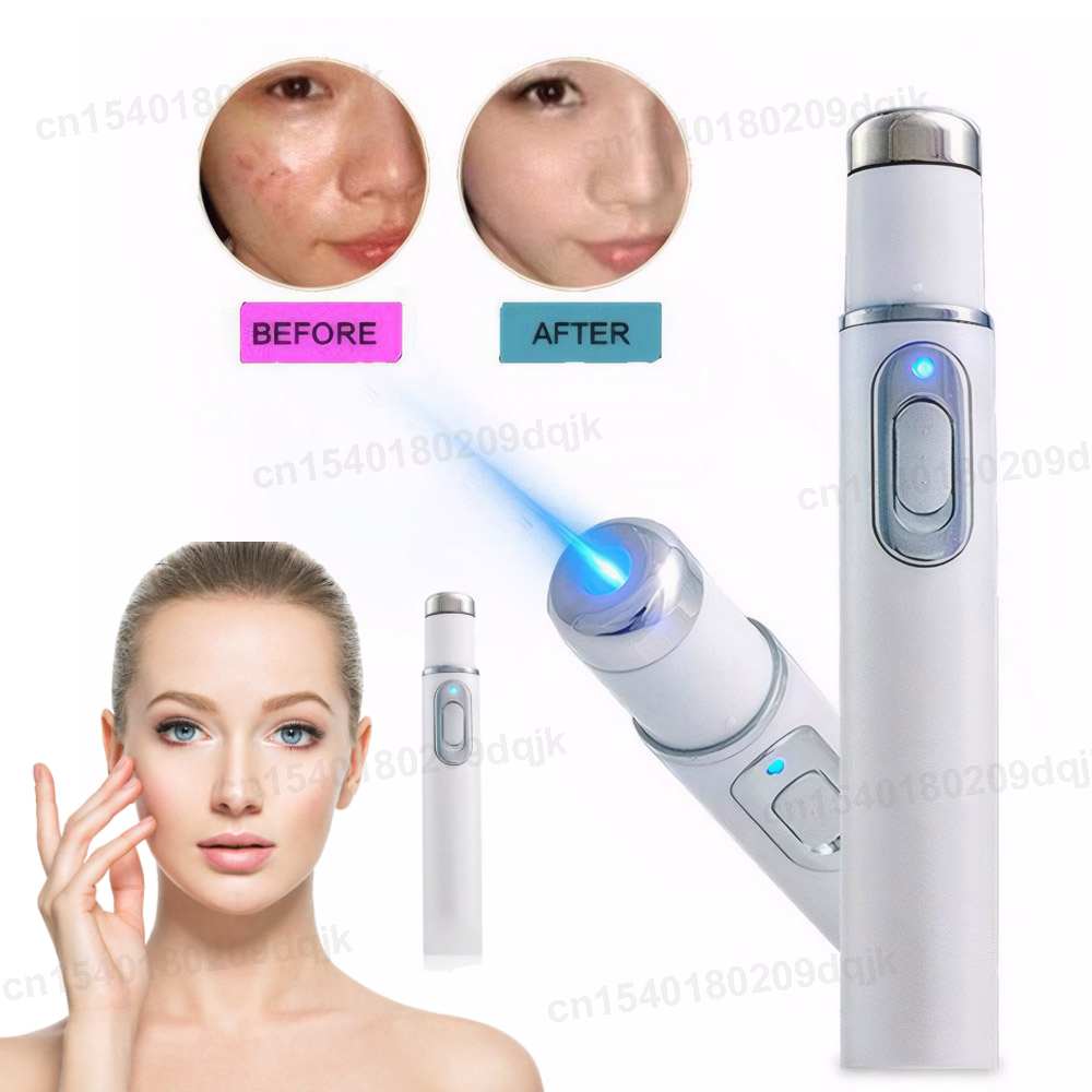 Acne Light Therapy Pen - Mavi Işık Terapisi Akne Kalem LED